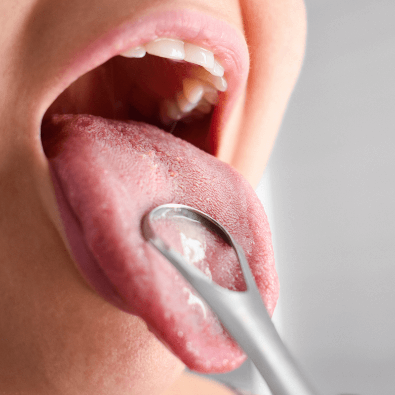 H2GLO™ Silver Tongue Cleaner Kit