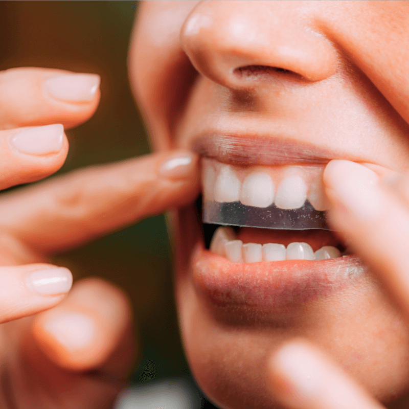 H2GLO™ Teeth Whitening Strips