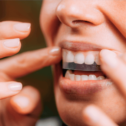 H2GLO™ Teeth Whitening Strips
